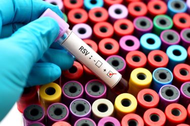 RSV – Respiratorisches Synzytial Virus