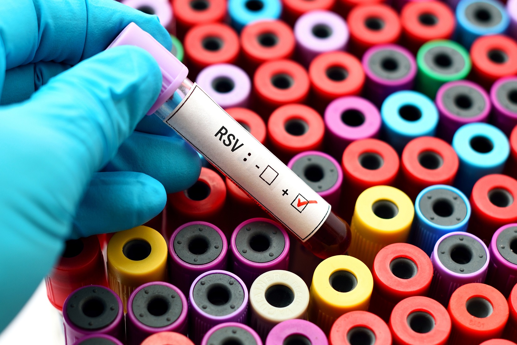 RSV – Respiratorisches Synzytial Virus