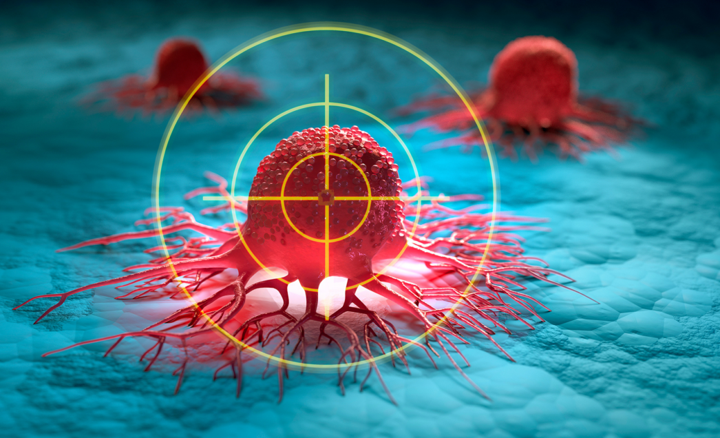 Neue Wege in der Krebstherapie: Von der Diagnose zur maßgeschneiderten Behandlung