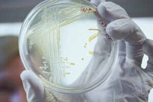 100 Triollionen Keime leben in unserem Darm.