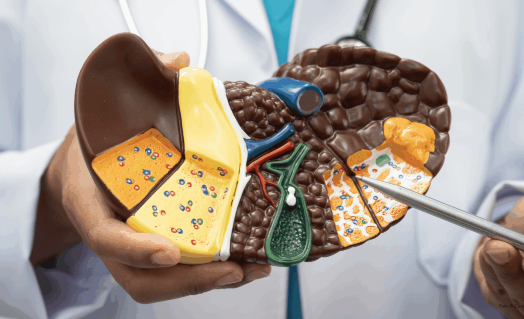Leber-Mythen im Check: Fettleber, Entgiftungskuren und Hepatitis